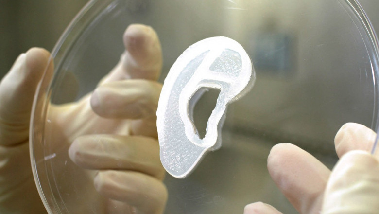  Primul implant de ureche imprimată 3D și realizată din celule umane vii a fost realizat în SUA
