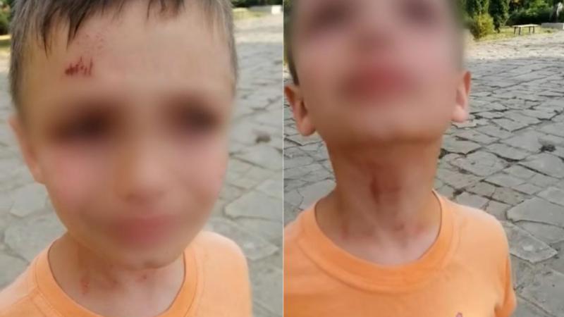  Doi copii au fost bătuți de un polițist de frontieră, la Basarabeasca. Reacția Ministerului de Interne