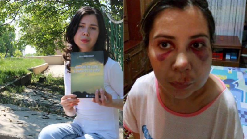 „Medicul m-a hărțuit si amenințat cu judecata”. Oxana Barbu, după ce a fost internată în spital, la Cimișlia: „Doamna ministră, vă rog ajutați-mă”