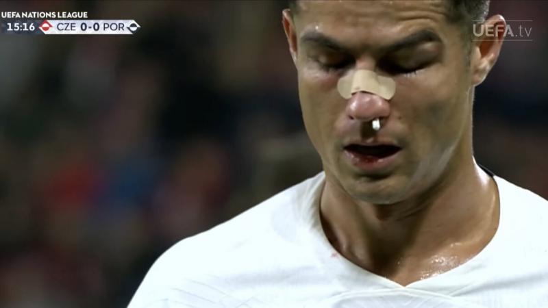  Cristiano Ronaldo a fost umplut de sânge și a avut nevoie de îngrijiri medicale, după o intervenție a portarului în meciul cu Cehia