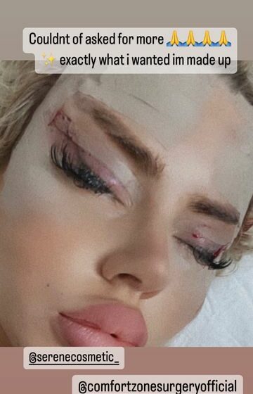  (foto) Cum arată o femeie după ce s-a operat estetic pentru a arăta ca păpușa Bratz