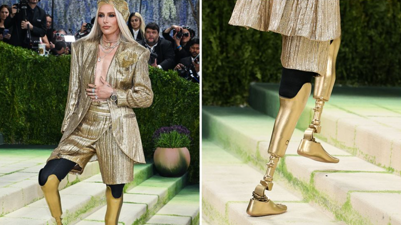 (foto) Cine este „fata cu picioarele de aur”, care a impresionat la Met Gala 2026. Și-a pierdut ambele picioare din cauza unei afecțiuni rare