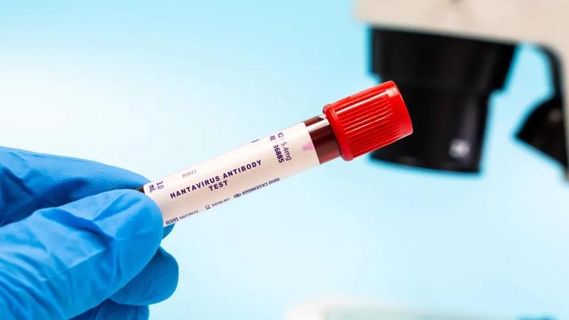 Agenția sanitară a UE a analizat tulpina de hantavirus care a declanșat epidemia mortală: Ce arată investigațiile preliminare